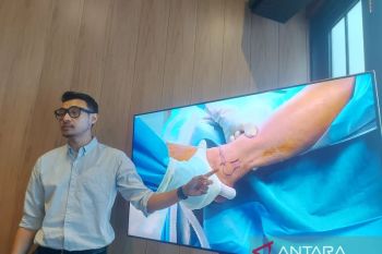 Pemilihan sepatu jadi faktor utama mencegah cidera kaki