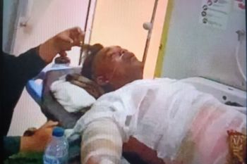 Seorang pekerja pabrik sawit PT BSS alami kecelakaan kerja hingga dirujuk ke RS M Djamil Padang