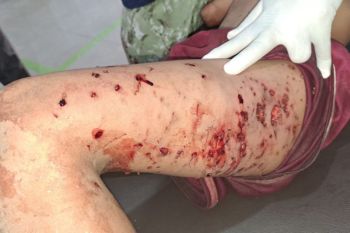 Makan korban, Warga Lombok Timur diminta waspadai anjing liar