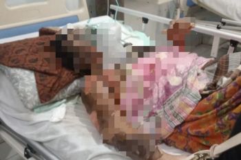 Suami bakar istri lantaran cemburu, pelaku dibekuk polisi
