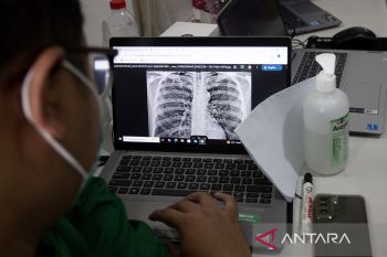 Skrining TBC di lapas Indramayu