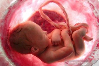 Dokter Ungkap Bahaya dan Alasan Kehamilan di Usia Remaja Tak Disarankan