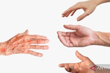 Dinkes P2KB ungkap situasi kusta di Gorontalo