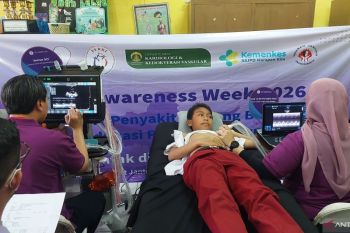 Program skrining siswa SD tingkatkan cakupan deteksi dini PJB