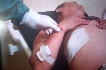 Polres Pasaman Barat tangkap pelaku penusukan