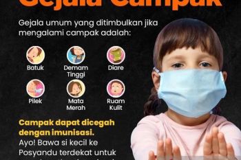 Lindungi nakes-named, Kemenkes keluarkan SE waspada campak