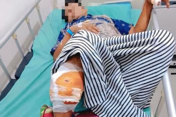 Seorang warga OKU alami luka serius, diserang beruang saat bekerja di kebun karet