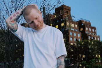 Ed Sheeran akui sempat terdiagnosis penyakit herpes