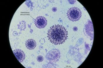 CDC AS nyatakan hantavirus sangat sulit menular dari orang ke orang