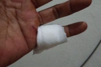 Tips penanganan kecelakaan kerja peserta BPJS Ketenagakerjaan agar tak kena deposit di RS