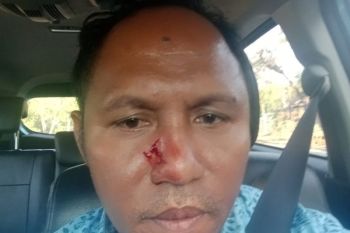 Sopir Lombok Taksi diduga dianiaya saat jemput wisatawan di Mandalika