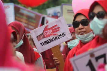 Dinkes Sumsel catat 9.548 kasus TBC hingga Juni 2026