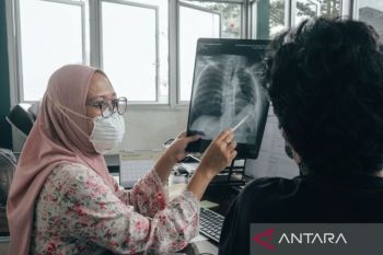 Paparan asap karhutla jangka panjang berisiko turunkan fungsi paru