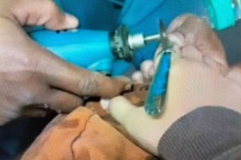 Cincin sulit lepas dari jari, petugas Damkar bisa bantu