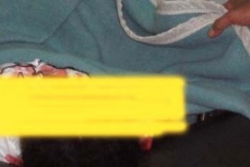 Nadia Tewas Akibat Ledakan Tabung Balon Gas di Karimun GAs