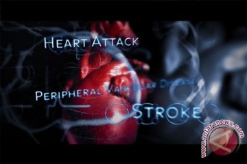 Perempuan 10 tahun lebih lambat alami serangan jantung