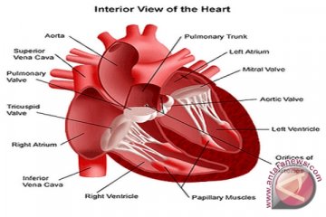 Anak terindikasi kelainan jantung perlu segera dilakukan tindakan