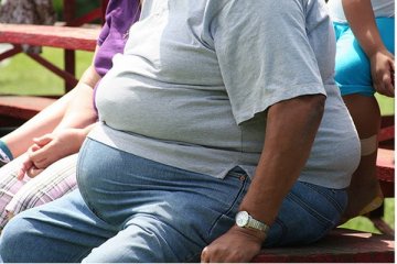 Obesitas di usia 30-an tingkatkan risiko derita demensia