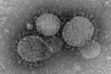 Kuwait laporkan kasus pertama koronavirus