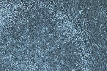 Ilmuwan ubah sel kulit jadi sel punca embrionik