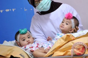 Bayi Kembar Siam
