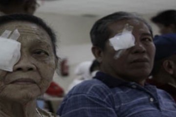 Operasi Katarak Gratis/Henky Mohari