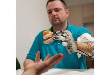 Tangan bionik mengembalikan sensasi menyentuh