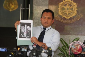 Soal donor organ, pemerintah perlu buat payung hukum