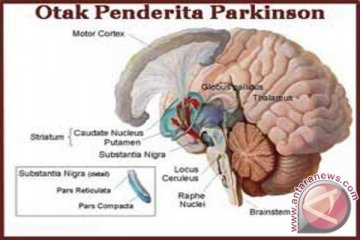 Periset Australia kembangkan hidrogel untuk lawan penyakit Parkinson