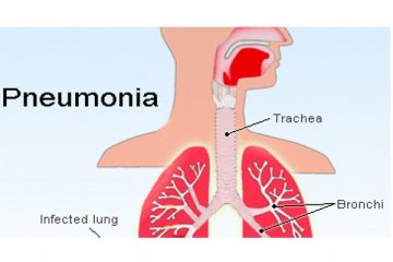 KBRI Beijing pastikan tidak ada WNI terjangkit wabah pneumonia berat