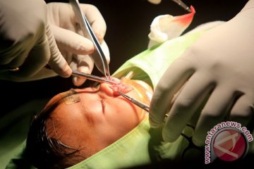 Pemkot Denpasar gelar operasi bibir sumbing gratis