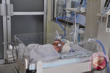 Bayi kembar siam asal Padalarang meninggal dunia