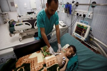 85.000 anak diduga telah meninggal akibat kelaparan di Yaman