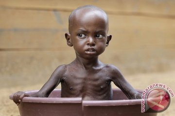 450.000 anak terancam kekurangan gizi akut di Nigeria