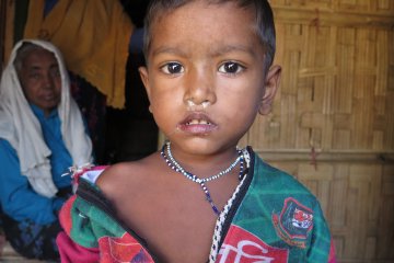 Anak-anak Rohingya kekurangan gizi di pengungsian Bangladesh