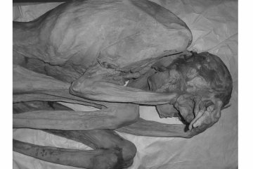 Tato tertua di dunia ditemukan pada mumi Mesir