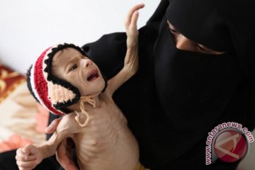 Dana bantuan tak kunjung datang, PBB ancam tutup 22 program di Yaman