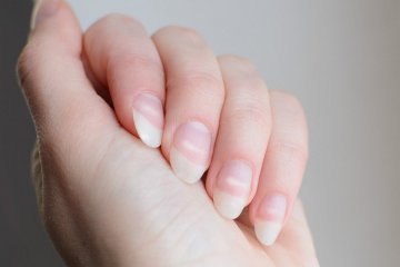 Mengidentifikasi penyakit dari perubahan bentuk kuku