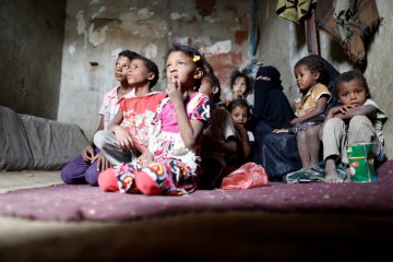 Anak-anak Yaman menderita gizi buruk