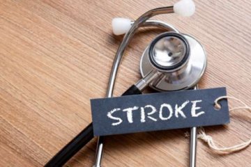 Hoaks! Berdiri dengan satu kaki dapat deteksi stroke