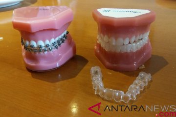 Kawat gigi tradisional atau "clear aligner", mana yang lebih baik?