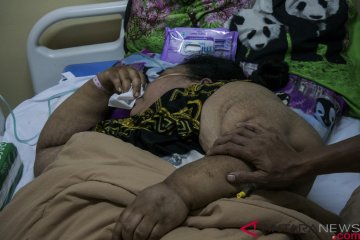 Sunarti, pasien obesitas asal karawang meninggal dunia