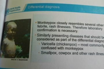 Mengenal penyakit zoonotic bernama cacar monyet