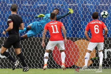 Chile hadapi dilema mainkan Sanchez atau tidak lawan Uruguay