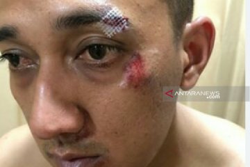 Polisi tembak bandar narkoba pengeroyok Kapolsek Patumbak