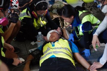 Kondisi wartawati Indonesia tertembak peluru karet di Hong Kong stabil