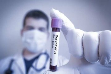 EU berupaya cegah AS ambil alih perusahaan riset vaksin corona
