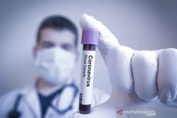 Laboratorium Amerika mulai uji antibodi COVID-19