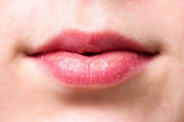 Cara agar bibir tak kering saat berpuasa