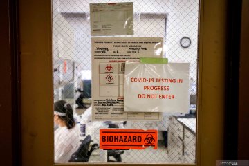 Test sampel COVID-19 di Dinas Kesehatan Kota New York